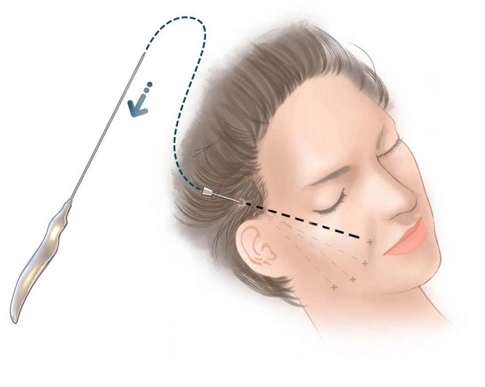 làm trắng da mặt sau sinh bằng sữa mẹ