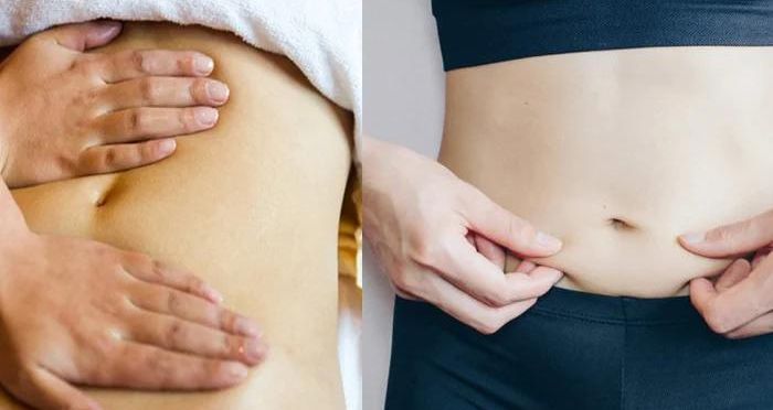 Cách massage giảm mỡ bụng sau sinh
