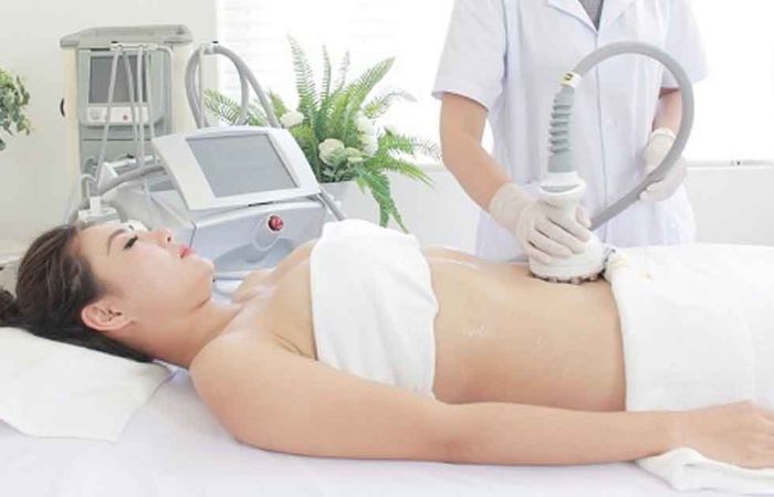 Chi phí giảm mỡ bụng bằng Laser Lipo