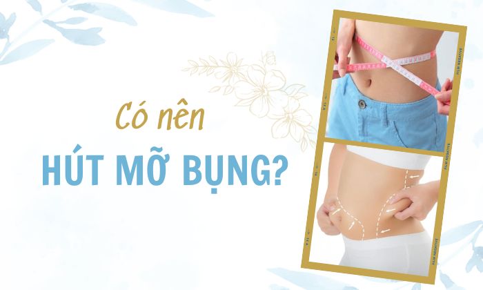 Công nghệ giảm mỡ bụng không phẫu thuật