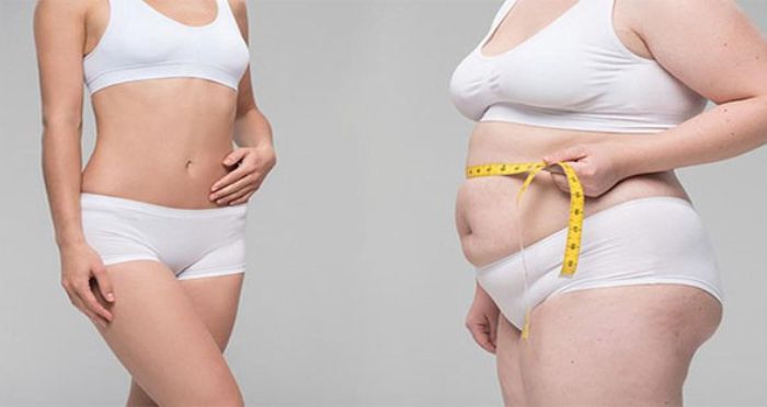 Giảm mỡ bụng sau sinh 1 năm