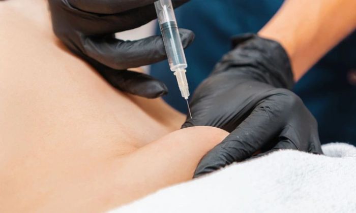 Tiêm giảm mỡ bụng giá bao nhiêu