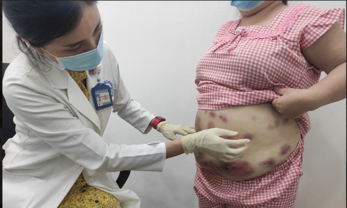 Tiêm giảm mỡ bụng giá bao nhiêu