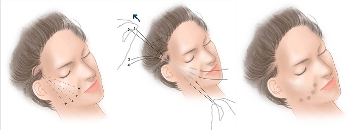 cách làm mịn da mặt đơn giản
