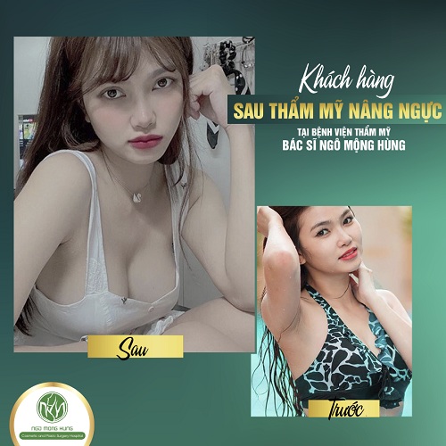 Các bài tập giúp ngực to