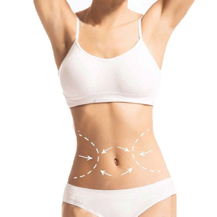 Hút mỡ có giảm cân không
