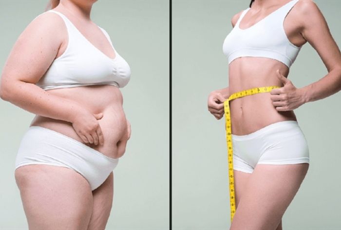 Hút mỡ bụng có để lại sẹo không