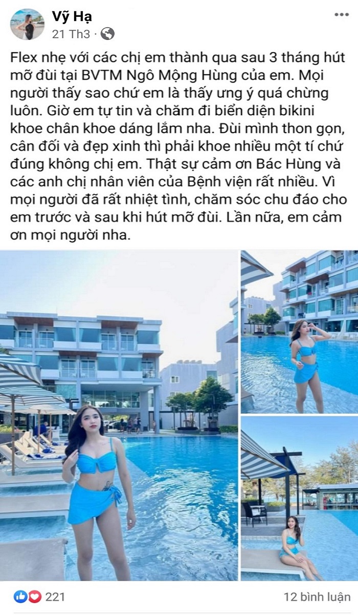 Hút mỡ đùi được bao lâu