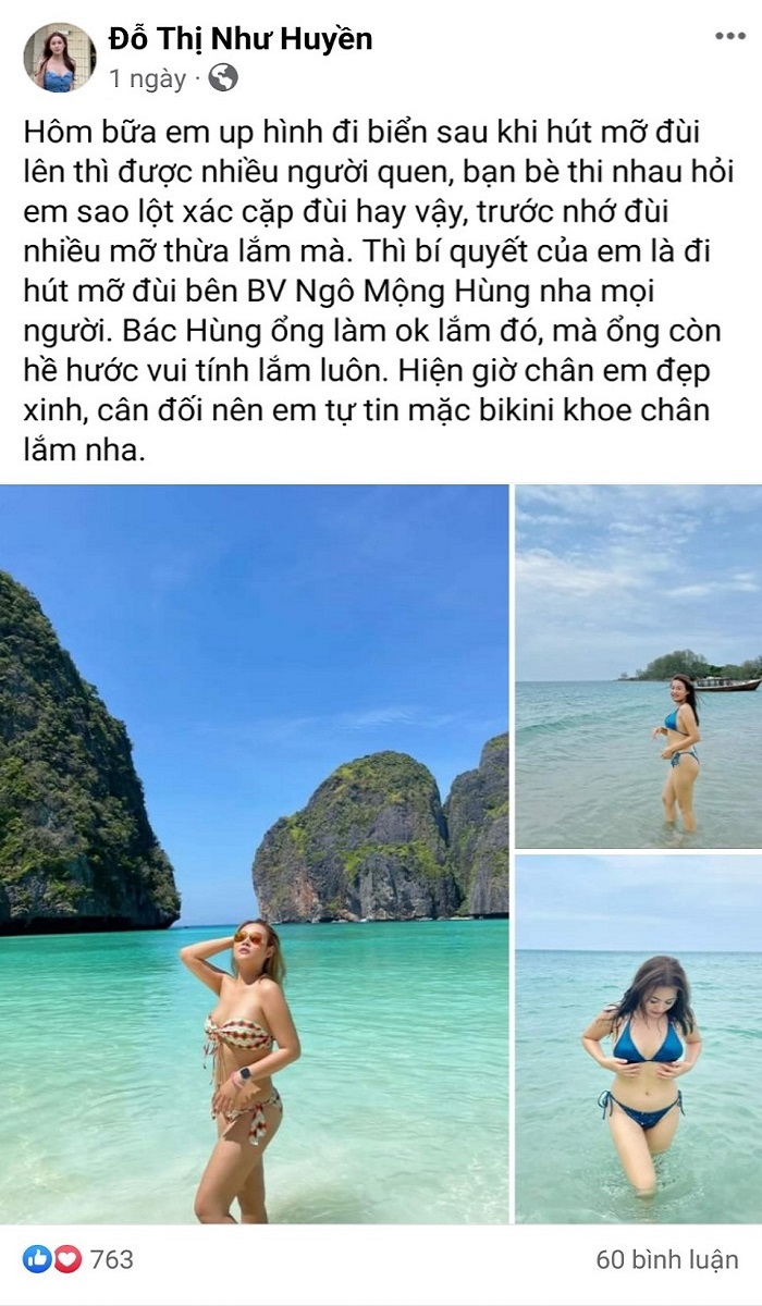 Hút mỡ đùi được bao lâu