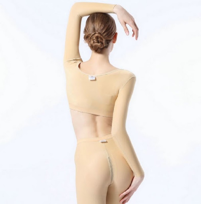 Hút mỡ bắp tay và lưng