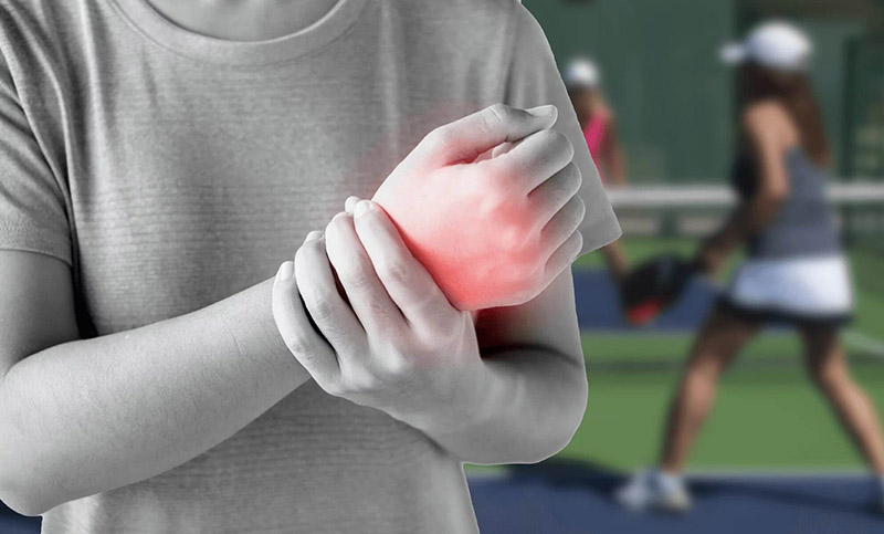 Các chấn thương khi chơi Pickleball và cách phòng tránh 1 Chấn thương cổ tay