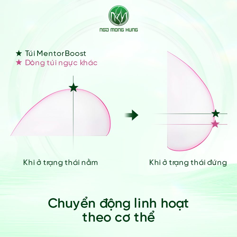 MENTOR MEMORYGEL BOOST DÒNG TÚI NGỰC CAO CẤP MỚI NHẤT