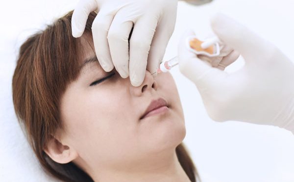 Tìm hiểu nâng mũi không phẫu thuật