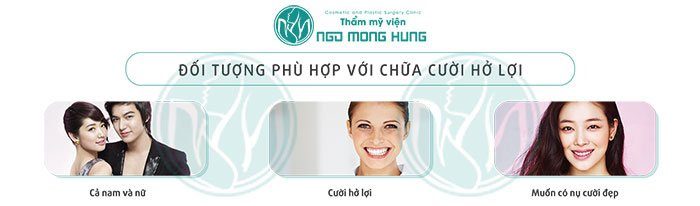 Cười bị hở lợi