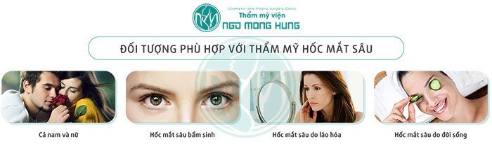 Con gái có hốc mắt sâu