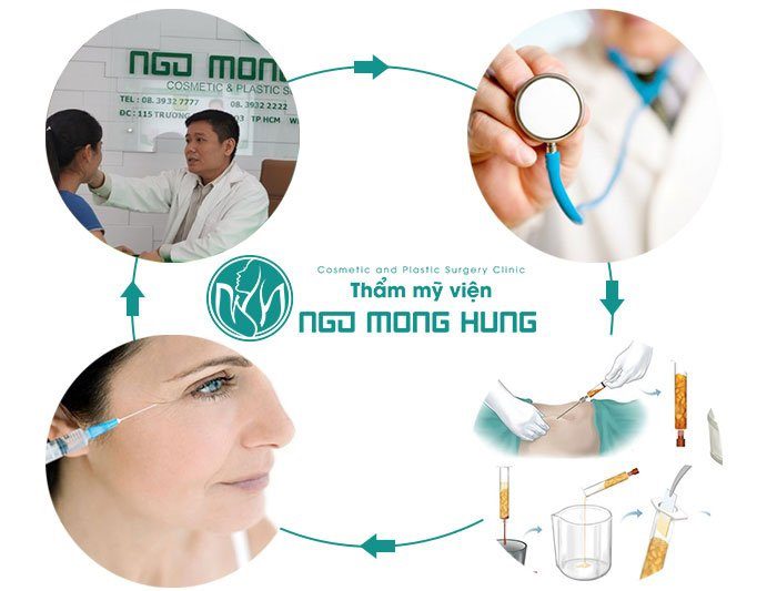 Hốc mắt bị sâu