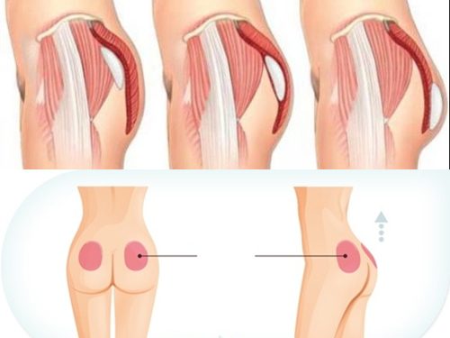 Quần độn mông bó eo