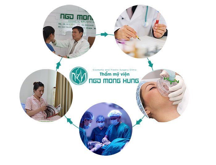 Gọt cằm chi phí