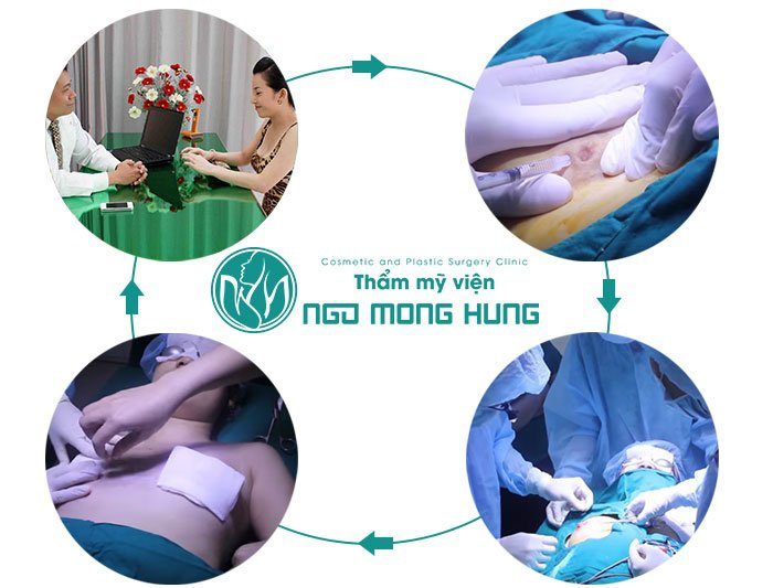 Chữa bệnh tụt núm vú