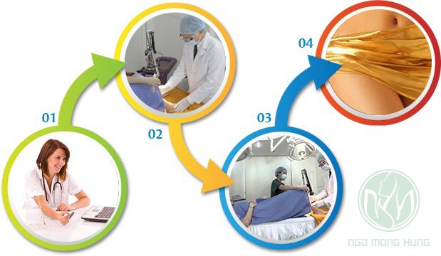 Mẹo se khít vùng kín sau sinh