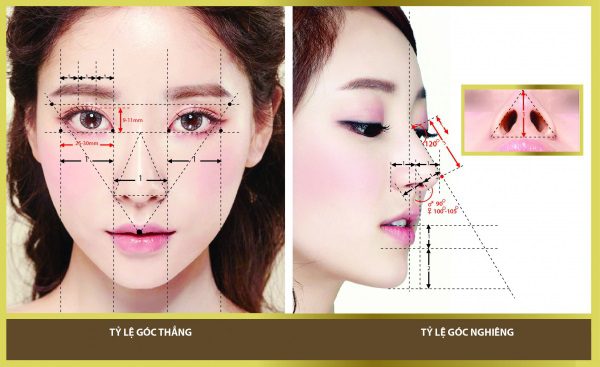 Nâng mũi cấu trúc