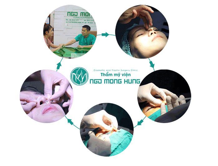 Nâng mũi Hàn Quốc có an toàn không