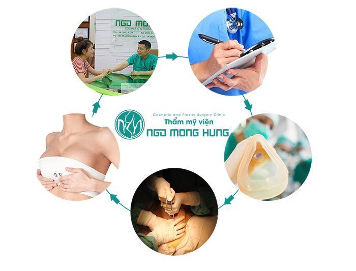 Phẫu thuật căng da ngực nội soi