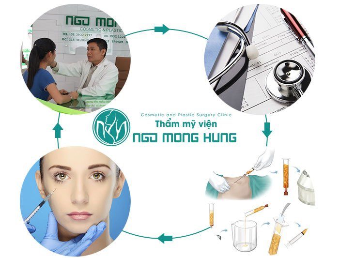 Thế nào là đôi mắt biết cười