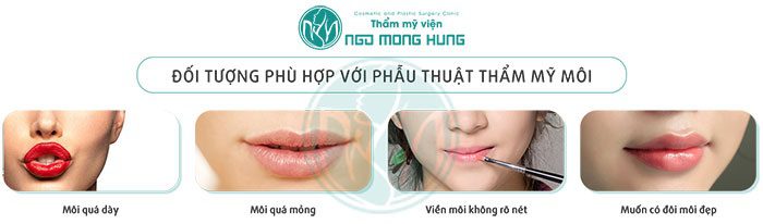 Phẫu thuật môi cánh cung