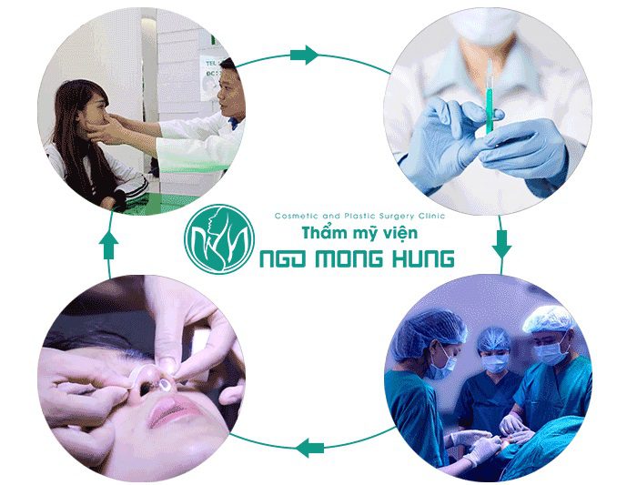 Mũi tẹt hếch