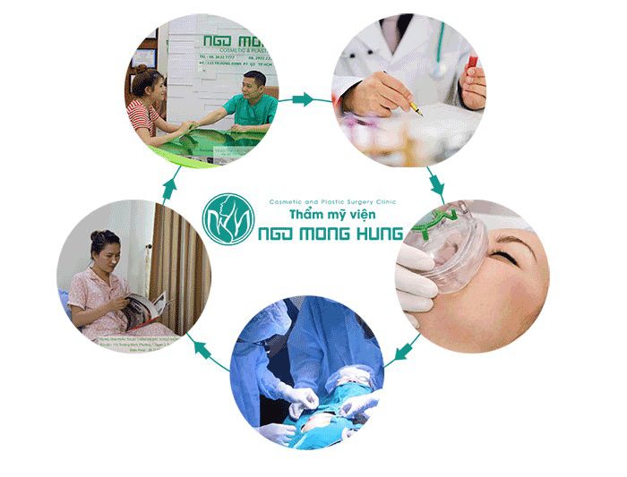 Thu nhỏ ngực phì đại